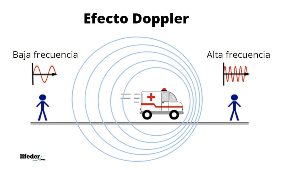 doppler